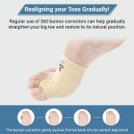 Pair of Bunion Corrector with Gel Cushions for Toe Realignment - Image 6