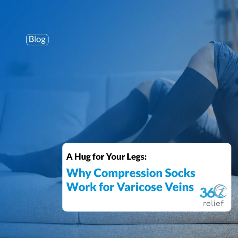 A Hug for Your Legs: Why Compression Socks Work for Varicose Veins